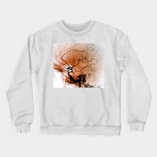 Cerebral aneurysm, angiogram (C037/0731) Crewneck Sweatshirt